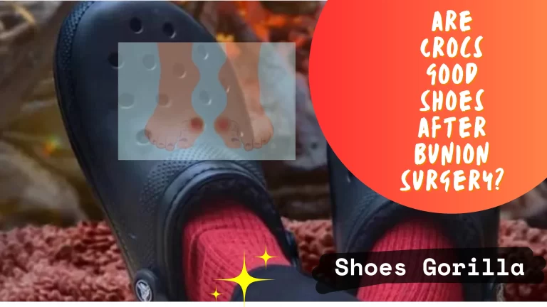 Are Crocs Good Shoes After Bunion Surgery?