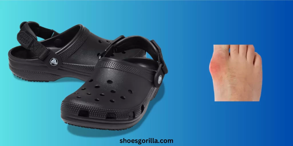 What Can You Wear Crocs After Bunion?